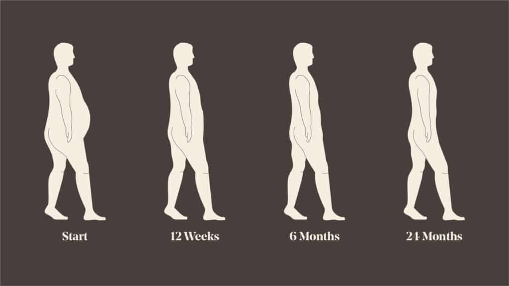 diagram showing weight loss progress from start, 12 week, 6 months to 24 months.